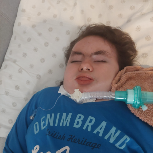 Każdego dnia toczy walkę o swoje życie! 2 Każdego dnia toczy walkę o swoje życie! 2